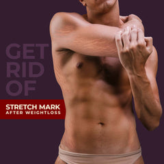 Stretch Marks Removal Cream To Reduce Stretch Marks & Scars| Delivery Stretch Marks Removal Cream